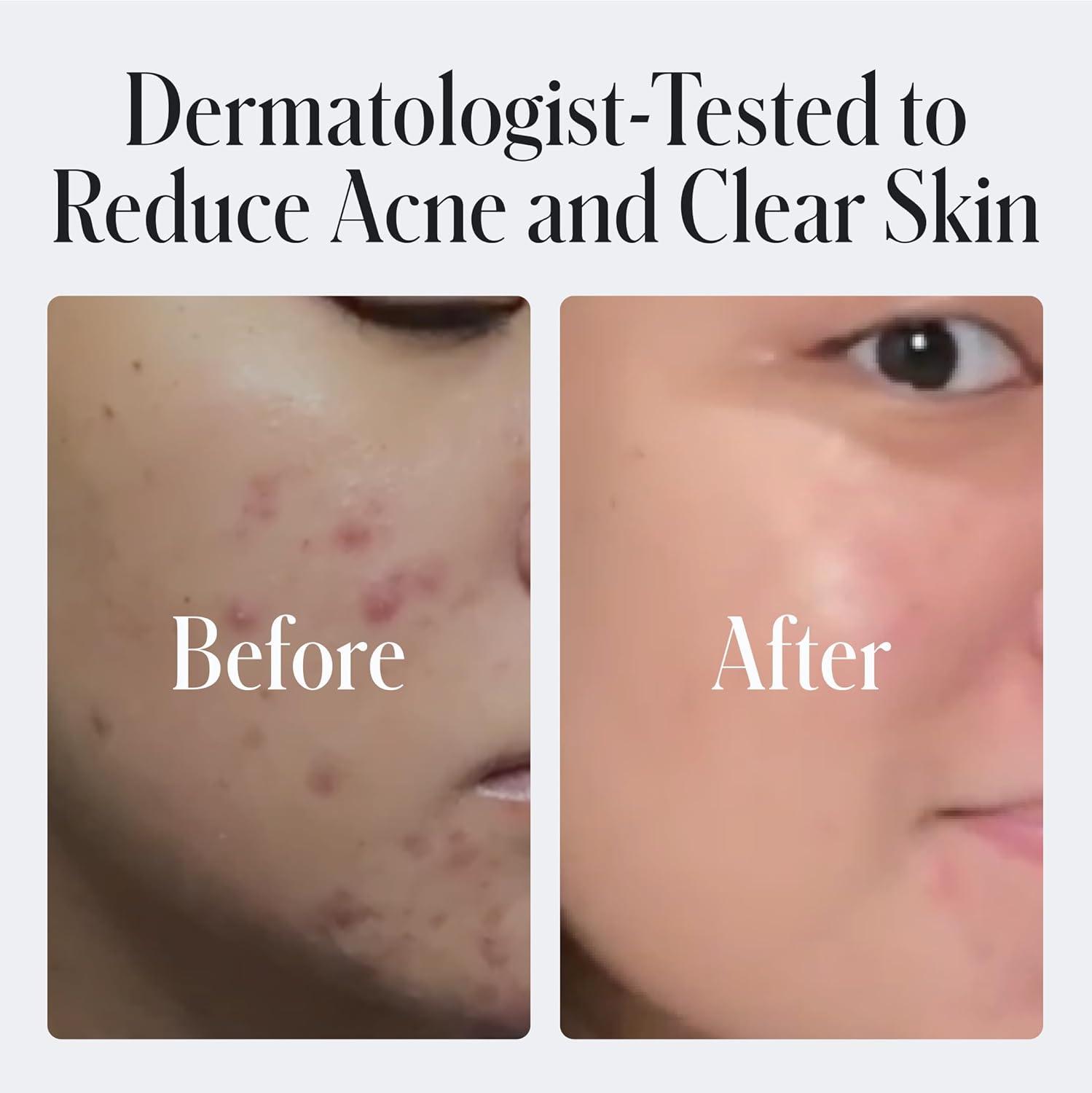 image:imageGeologie 2 Salicylic Acid Face Wash Bergamot Juniper Scent Facial Cleanser for Men amp Women Acne amp Oil Control Deep Cleansing amp BHA Exfoliating Face Wash 2Pack205 Fl Oz Pack of 4