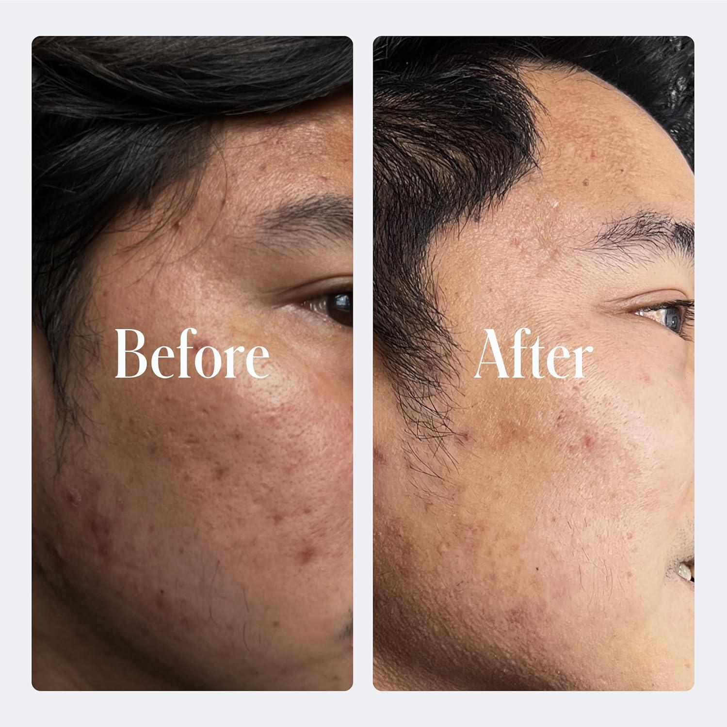image:imageGeologie Retinol AntiAging Face Cream Advanced 3 Retinol Formula for Effective Results Reduce Fine Lines amp Wrinkles Protect amp Repair Skin With Hyaluronic Acid amp Niacinamide For Men amp WomenUltra Strength