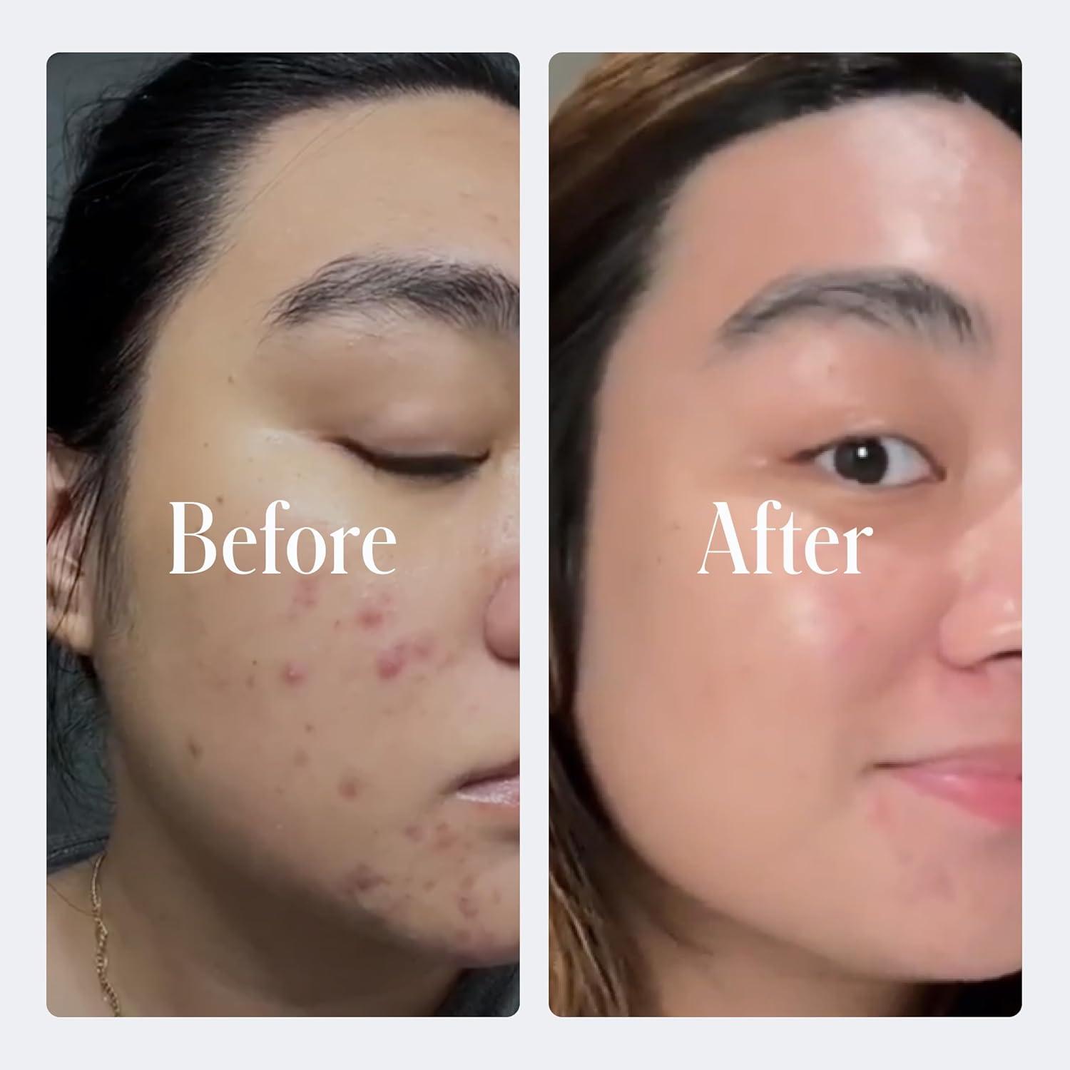 image:imageGeologie Retinol AntiAging Face Cream Advanced 3 Retinol Formula for Effective Results Reduce Fine Lines amp Wrinkles Protect amp Repair Skin With Hyaluronic Acid amp Niacinamide For Men amp WomenRegular Strength